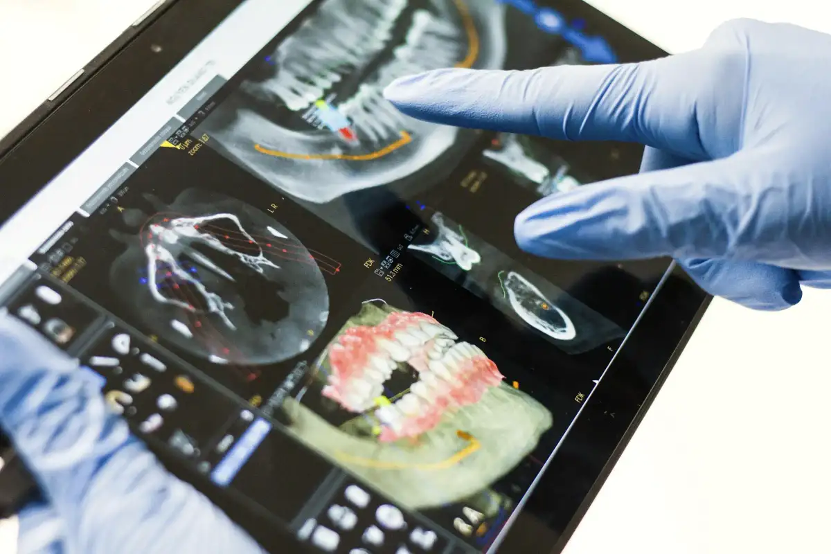 A gloved hand pointing at a 3D scan of teeth on a tablet